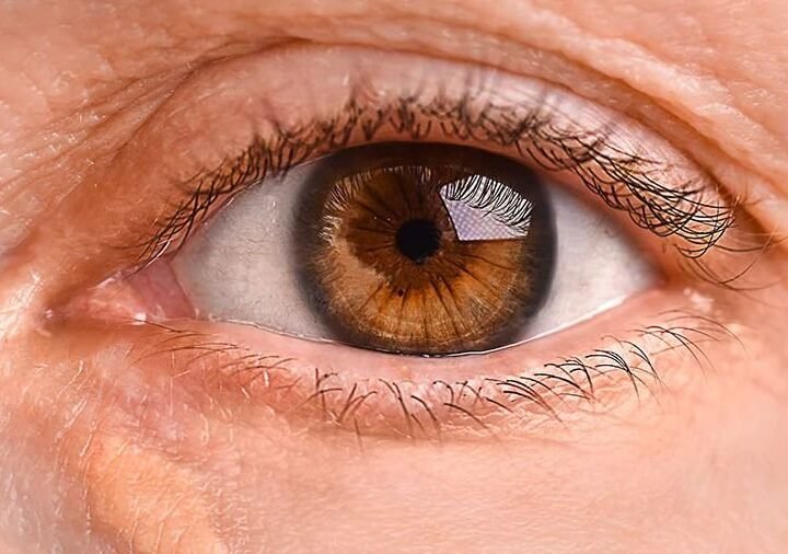 Taches jaunâtres autour des yeux : un indicateur de risques cardiovasculaires