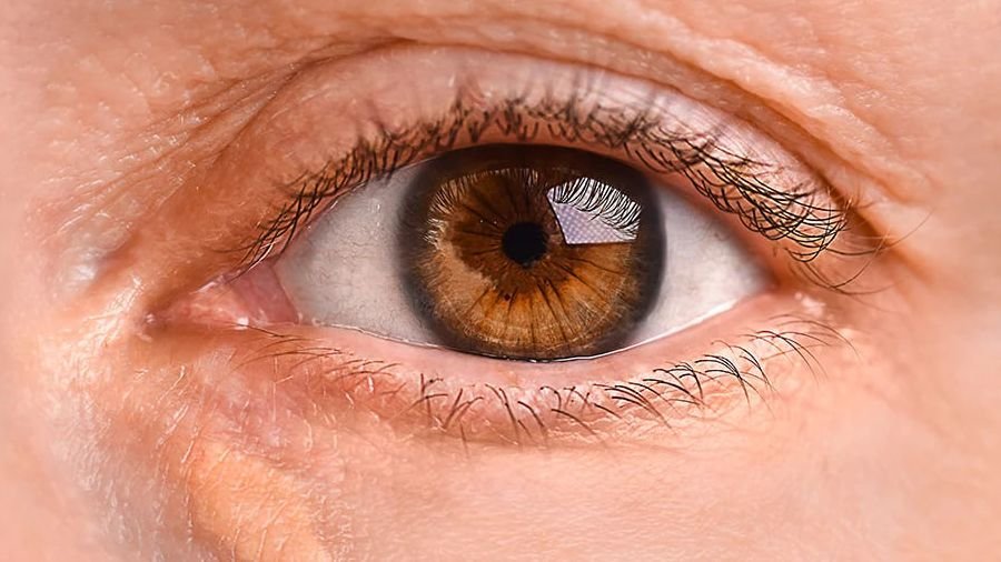 Taches jaunâtres autour des yeux : un indicateur de risques cardiovasculaires